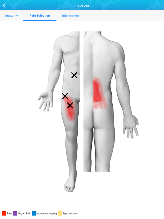 Screenshot #5 pour Referred Pain Index