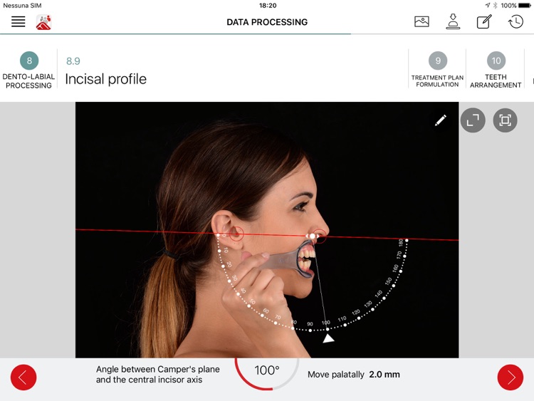 Fradeani App