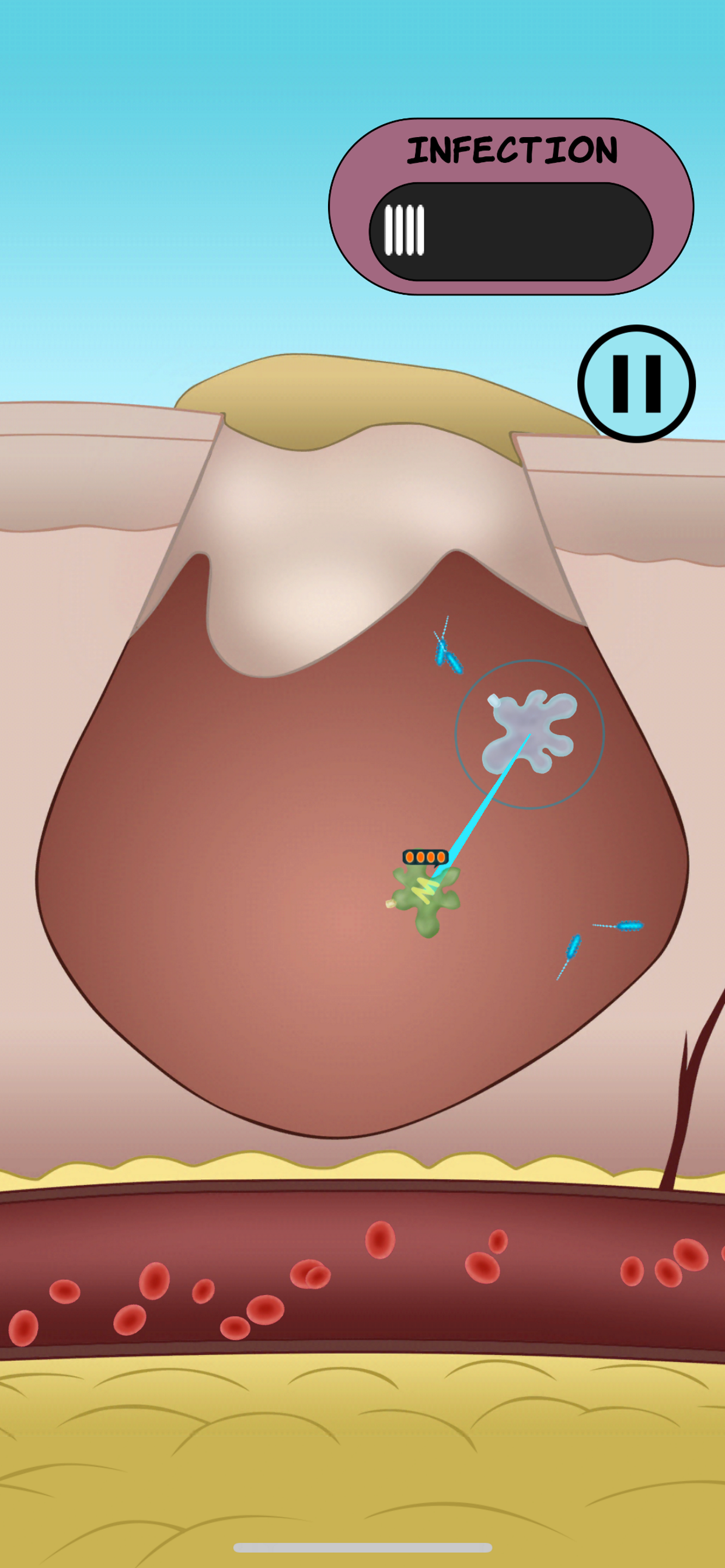 Dermis Defense screenshot 4