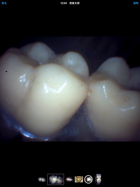 DentalShot screenshot-9
