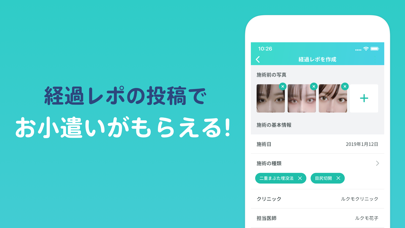 ルクモ（Lucmo）美容整形の写真口コミ・... screenshot1
