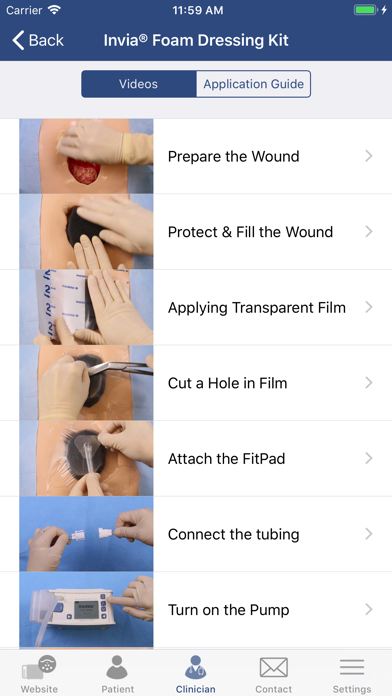 Medela NPWT Screenshot