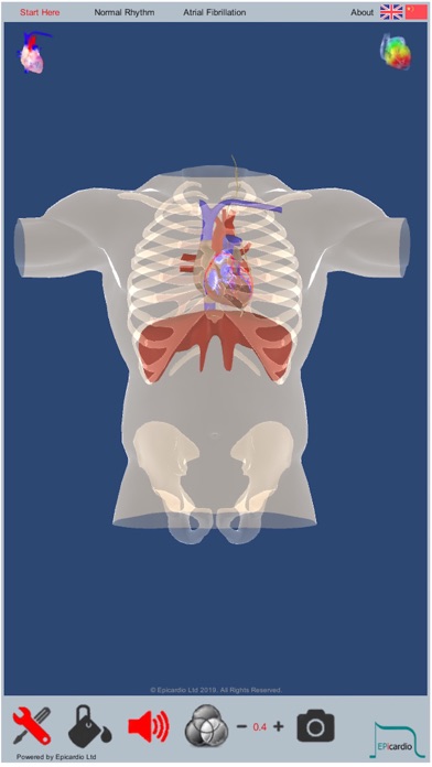 Intelligent Heart Sim AFib screenshot 2