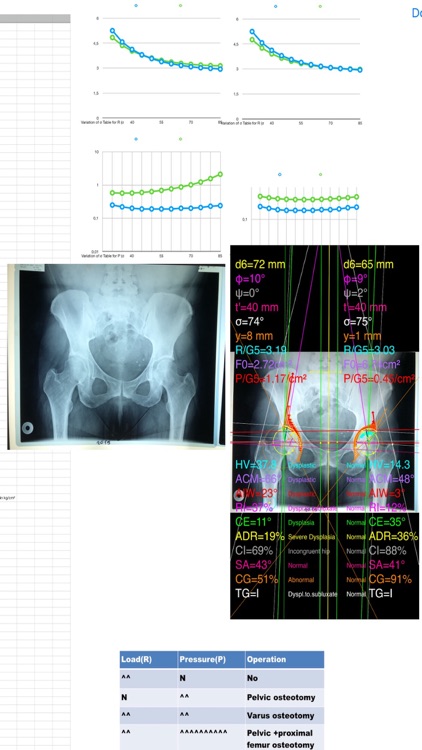 HipDysplasiaPro screenshot-4