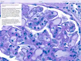 Game screenshot Renal Transplant Pathology hack