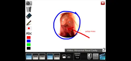 Sinus ID