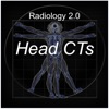 Radiology 2.0: Head CTs