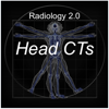 Radiology 2.0: Head CTs - Daniel Cornfeld