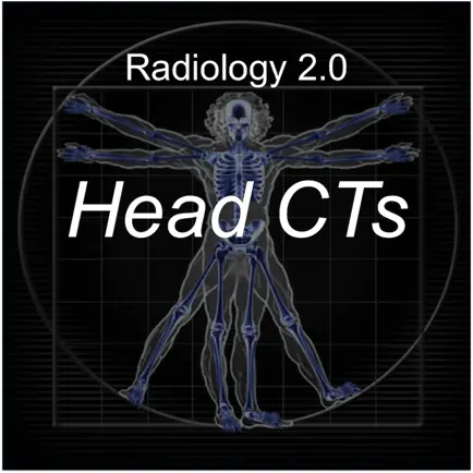 Radiology 2.0: Head CTs Cheats