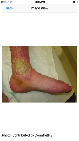 Game screenshot Wound Care Nursing hack