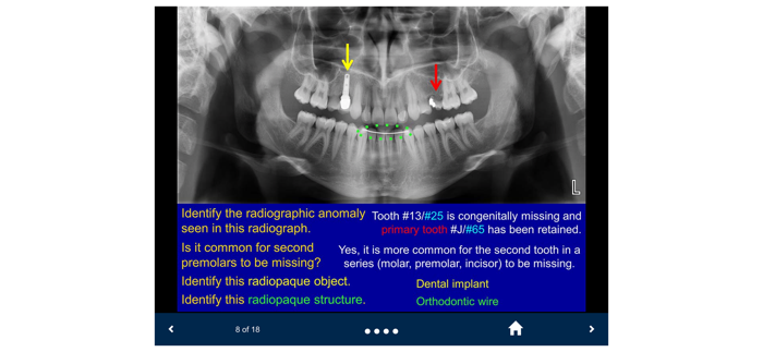 Oral Radiology - SecondLook