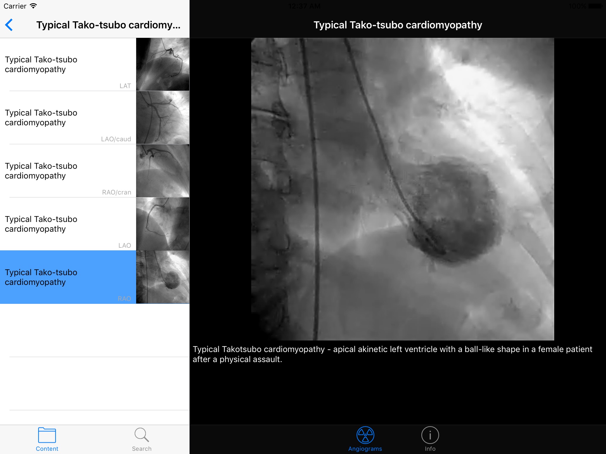 CARDIO3®Invasive Cardiology HD screenshot 4