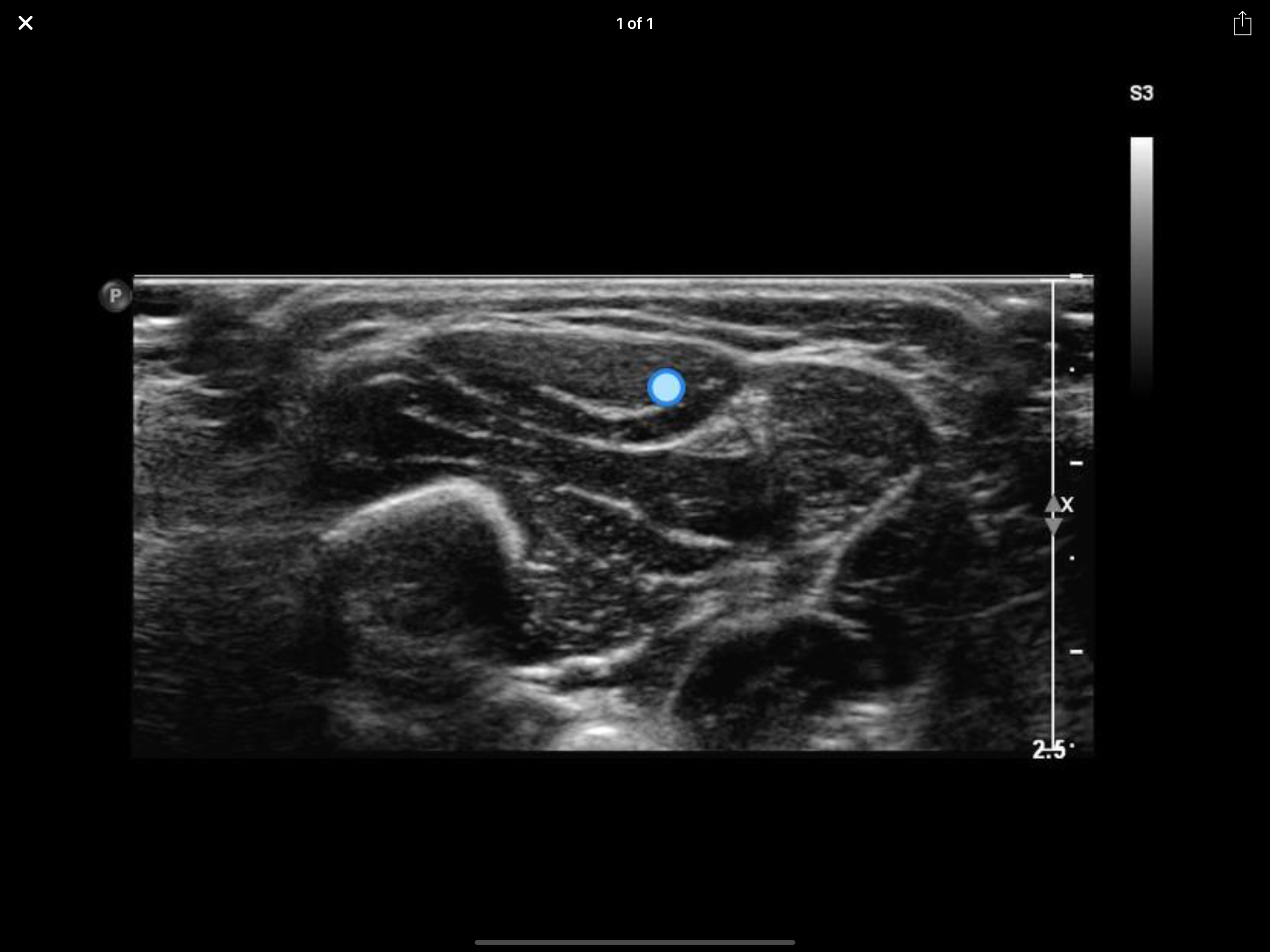 Muscle Ultrasound Course