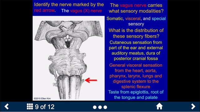 Neuroanatomy Lite - SecondLook(圖4)-速報App