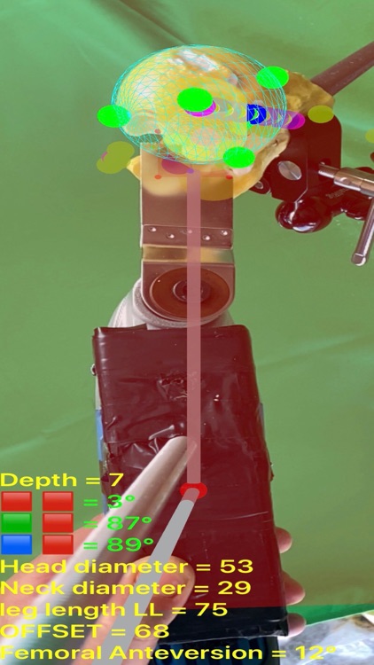 FemurOsteotomyTHR screenshot-8