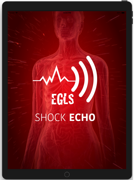 Screenshot #4 pour Shock-Echo