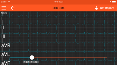 Screenshot #3 pour Spaulding ECG