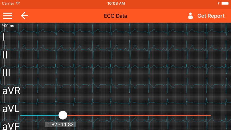 Spaulding ECG