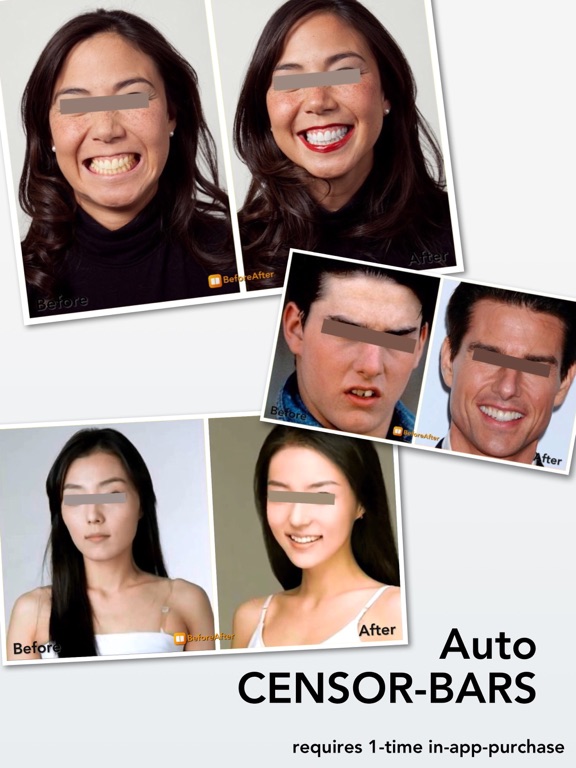 BeforeAfter, Instant Watermark iPad screenshot 4 - Photo & Video app