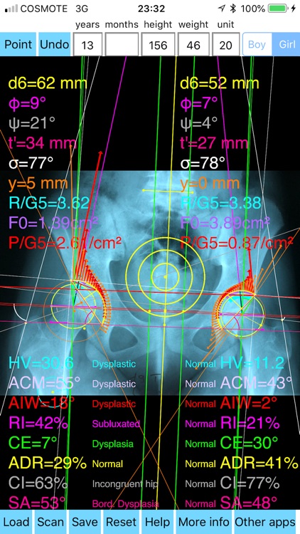 HipDysplasiaPro screenshot-5