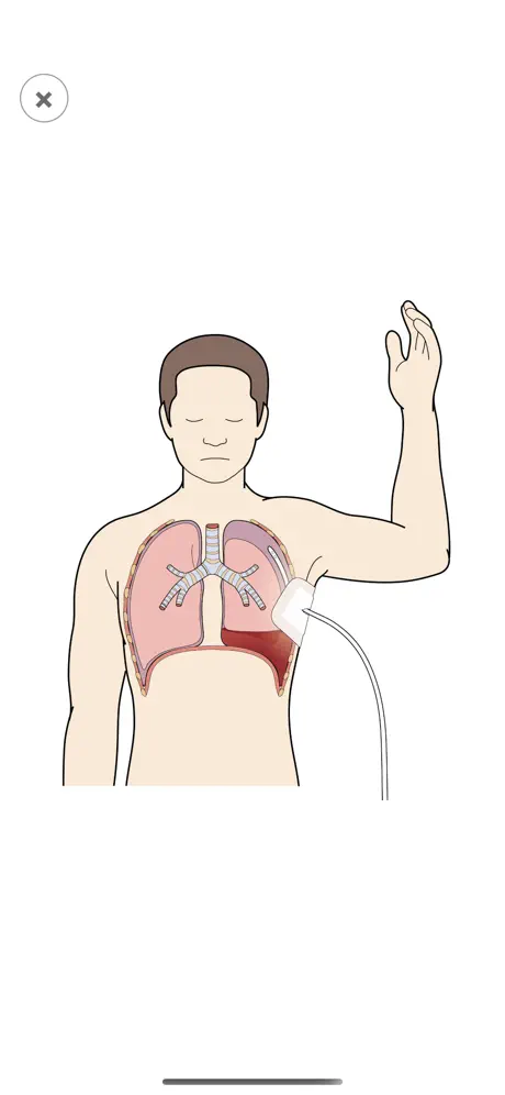 BASIC LR for Nurses Instructor
