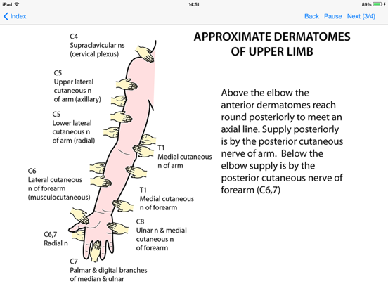 Tricky Areas of Anatomy iPad screenshot 5 - Medical app