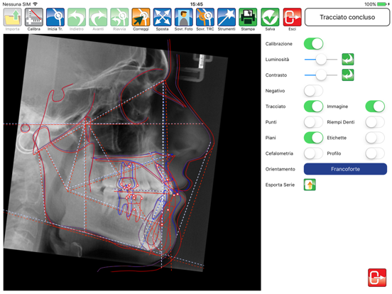 Screenshot #5 pour Delta-Dent