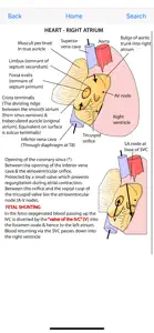 Instant Anatomy Flash Cards screenshot #5 for iPhone