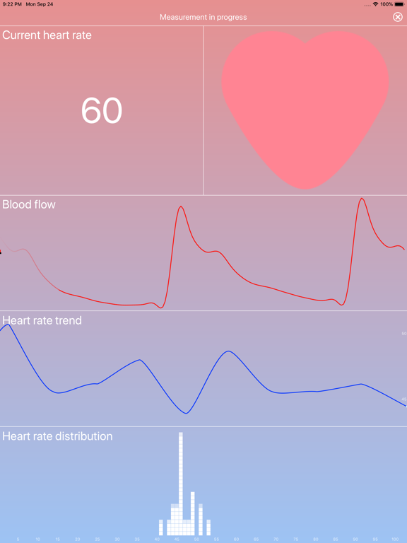 Screenshot #4 pour HEARTshape - Pulse and Fitness