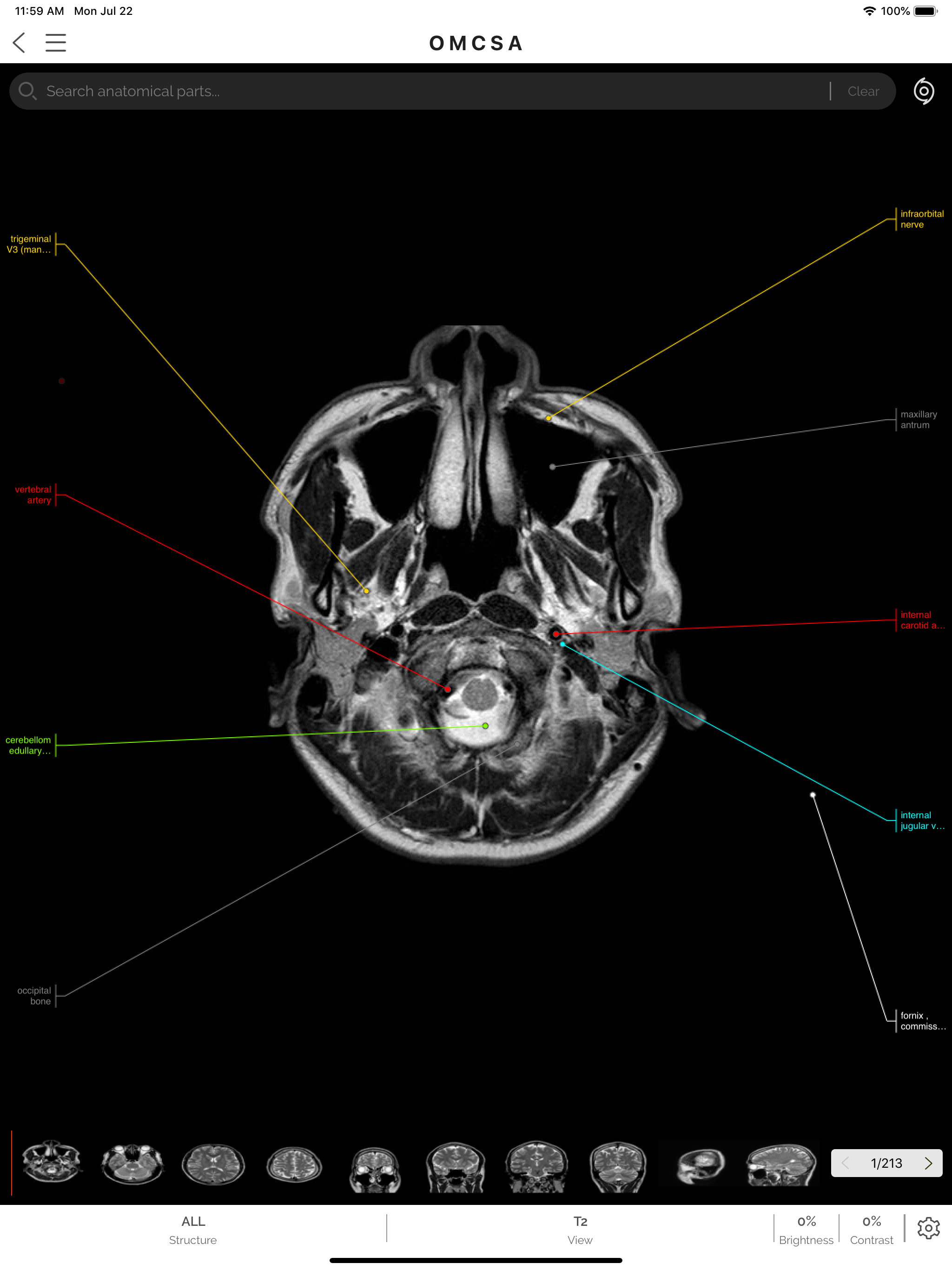OMCSA k-anatomy