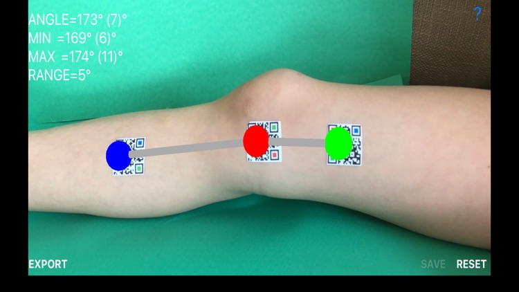 DynamicGoniometerAR screenshot-5