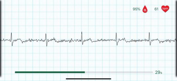 WIWE - ECG diagnostics