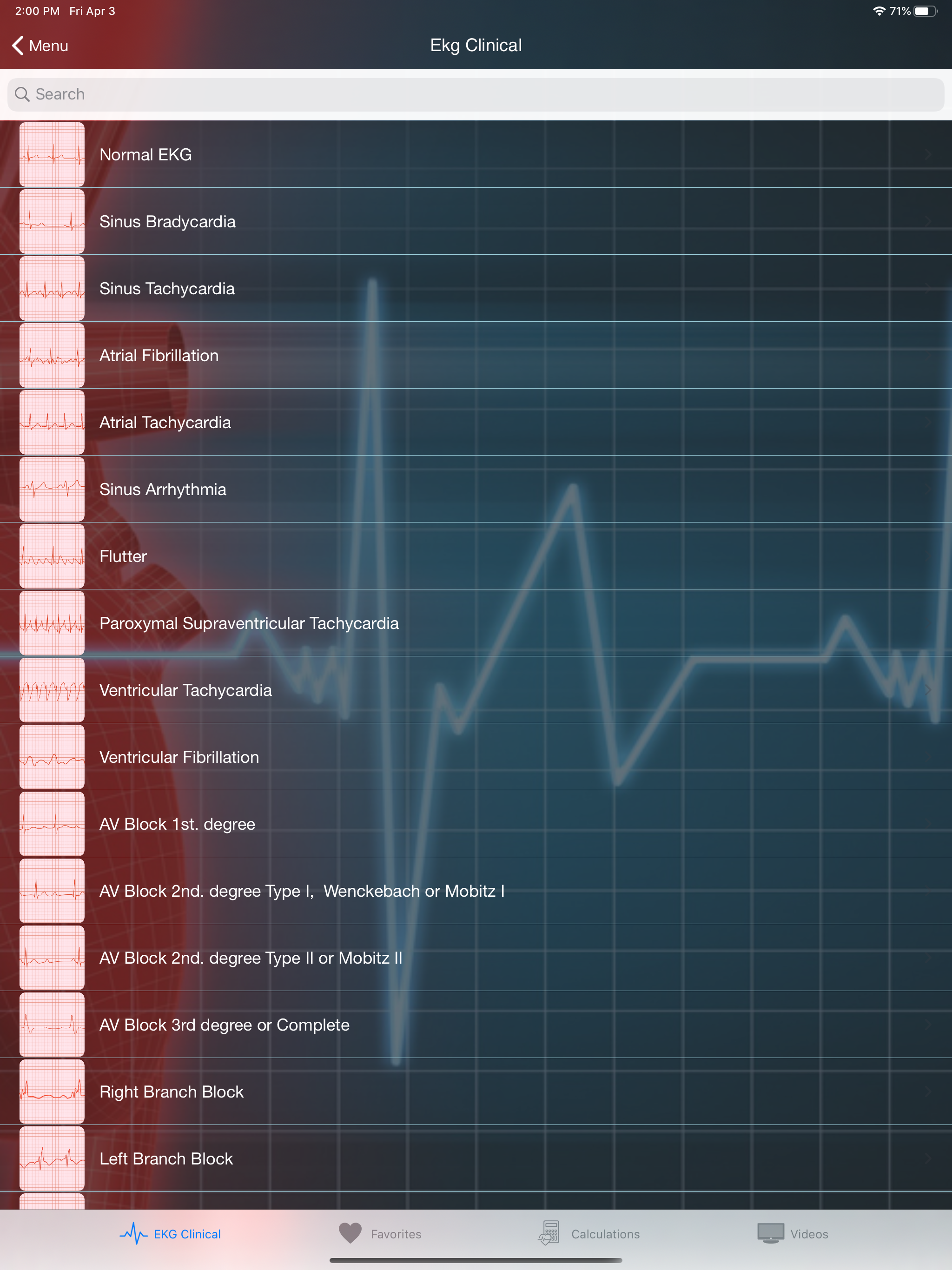 EKG Clinical