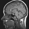 MRI Viewer - Lieu Duong