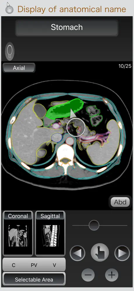 CT Passport Abdomen