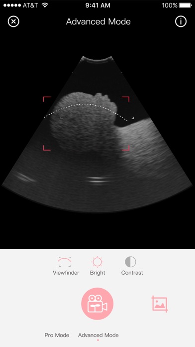 Fetus Camera screenshot 2