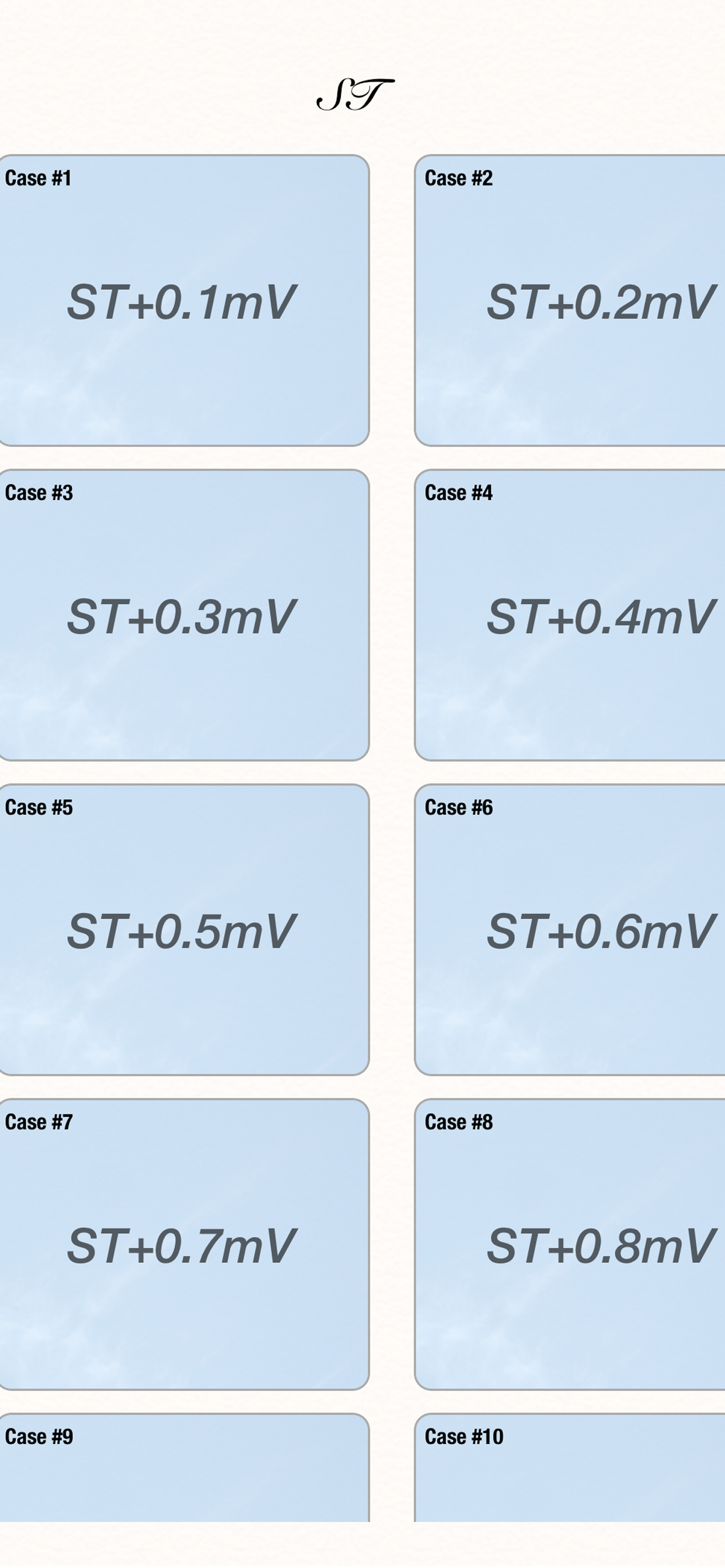 ECG Simulator