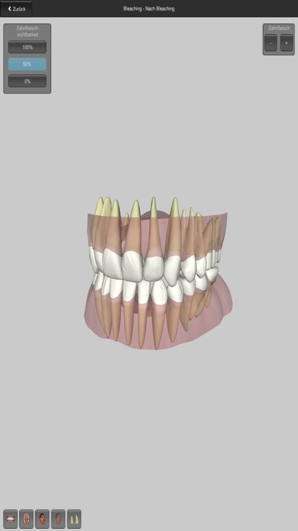 CGM VISODENT 3D App