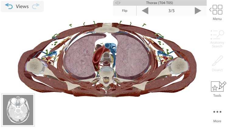 Human Anatomy Atlas 2020 screenshot-4