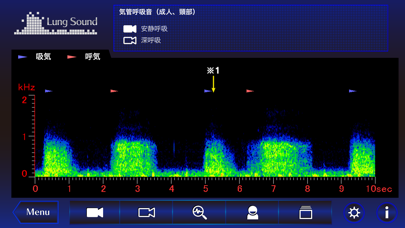 肺の聴診トレーニング - 見える肺音のおすすめ画像2