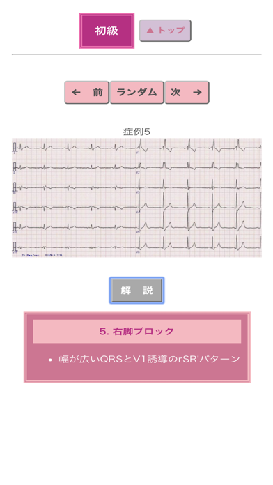 ポケット心電図のおすすめ画像2