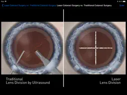 Sight Selector Subscription screenshot 8