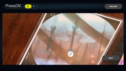 Nexus Spine screenshot 2