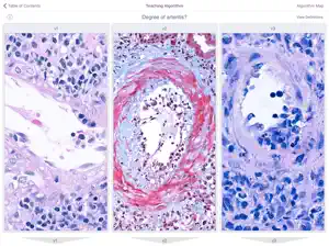 Renal Transplant Pathology screenshot #7 for iPad