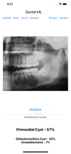 Dental ML screenshot #3 for iPhone