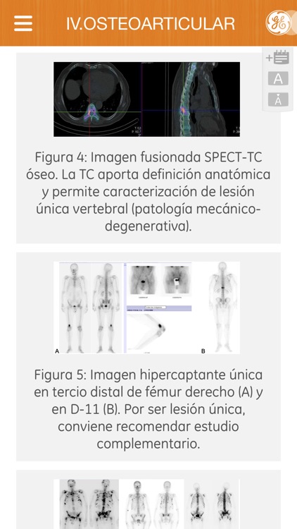 Manual de Medicina Nuclear screenshot-3