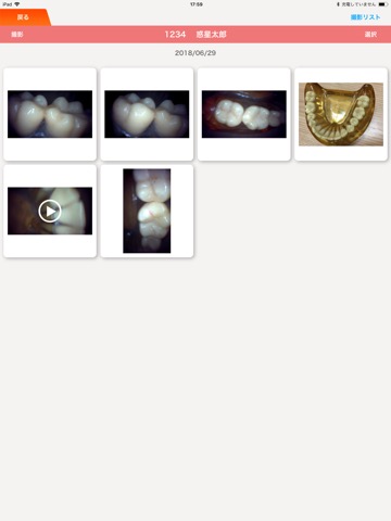 DentalShotのおすすめ画像8