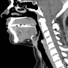 CT Neck - Lieu Duong