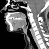 CT Neck App Feedback