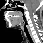 CT Neck App Contact